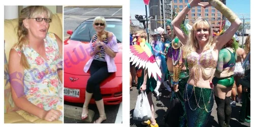 Weight Loss Surgery before and after Man - I received a call today from a patient considering surgery. I of course, told him...