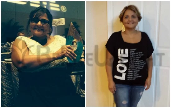 Weight Loss Surgery before and after Patient - Hello,I wanted to share my 2 month update. So far from 10/6 to 12/14 I've...