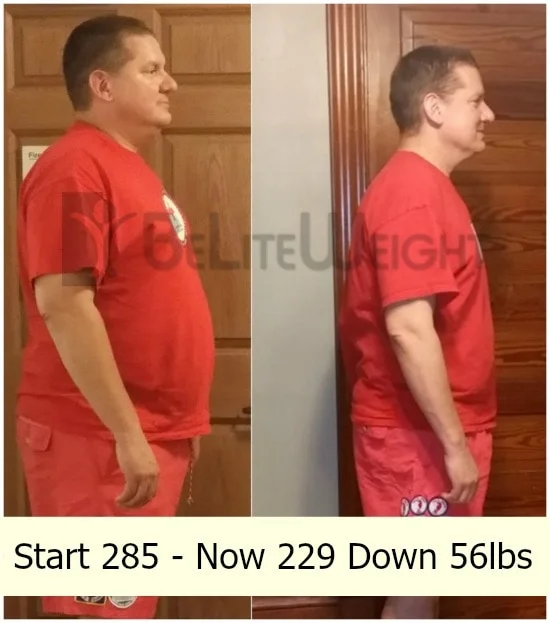 Weight Loss Surgery before and after Man - Wayne sent his 3 month update. He's down 56 pounds!**See below