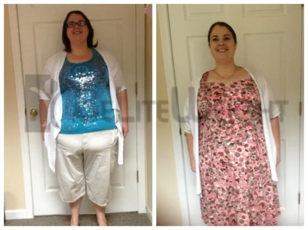 Weight Loss Surgery before and after Woman - Mary sent her photos to us. She's lost a total of 67 pounds in a...