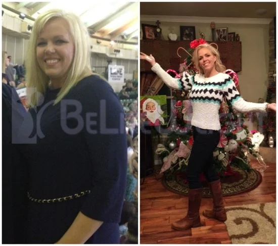 Weight Loss Surgery before and after Patient - JoAnne and Nicky:The team at BeLiteWeight has really changed my life. I'm down 65 pounds...