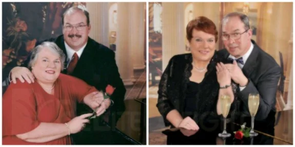 Weight Loss Surgery before and after Woman - I promised JoAnne I would share these. The "after" Gastric Sleeve photo is taken at...