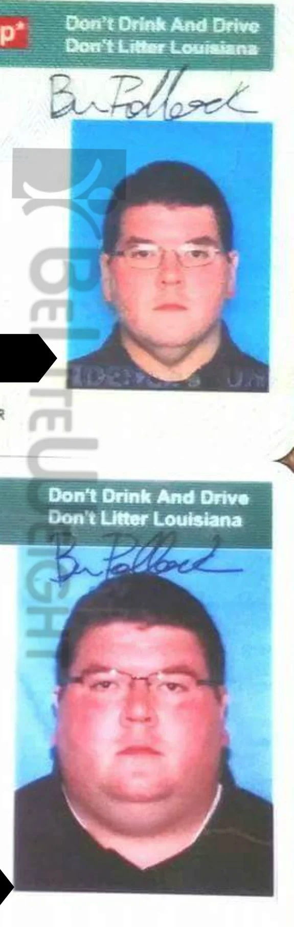 Weight Loss Surgery before and after Patient - Hello again. I just wanted to drop another progress report. I've now lost 167 lbs...