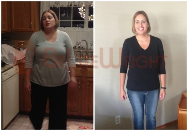 Gastric Sleeve Weight Loss Results