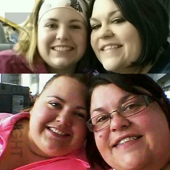 Weight Loss Surgery before and after Woman - Please see our attached pictures. The original was taken on June 30th, sitting at the...