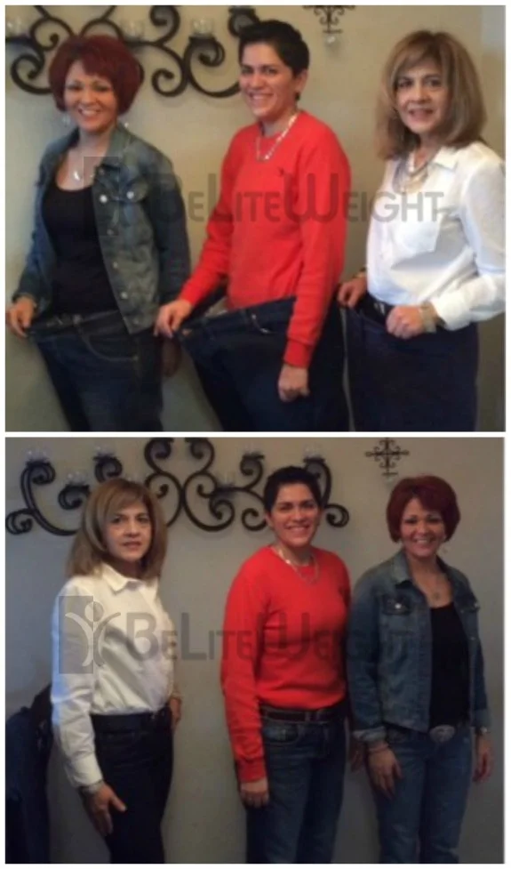 Weight Loss Surgery before and after Woman - Celia, Nicole and Marisa all had their VSG surgeries on the same day one year...