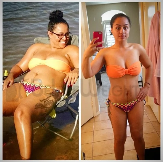 Weight Loss Surgery before and after Patient - In just 4 months I've lost 45 pounds!* I'm so happy I choose to have...