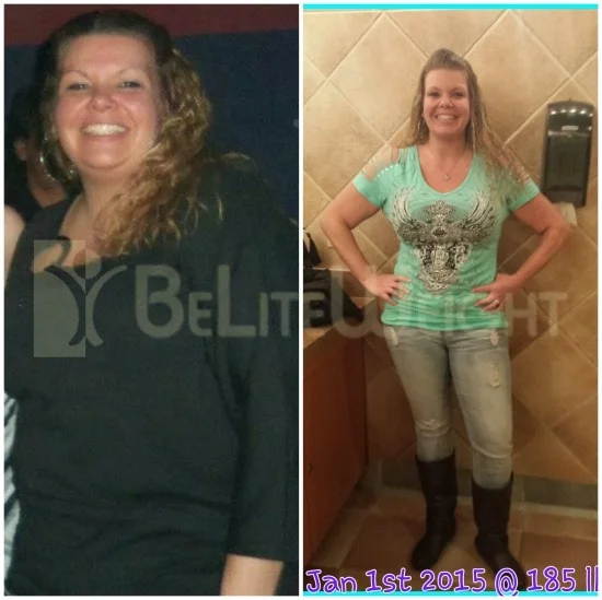 Weight Loss Surgery before and after Patient - Hi everyone... Just wanted to let y'all know I'm doing great! Didn't lose as many...