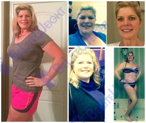 Weight Loss Surgery before and after Patient - I wanted to send an updated picture. I am still 7 pounds from what I...