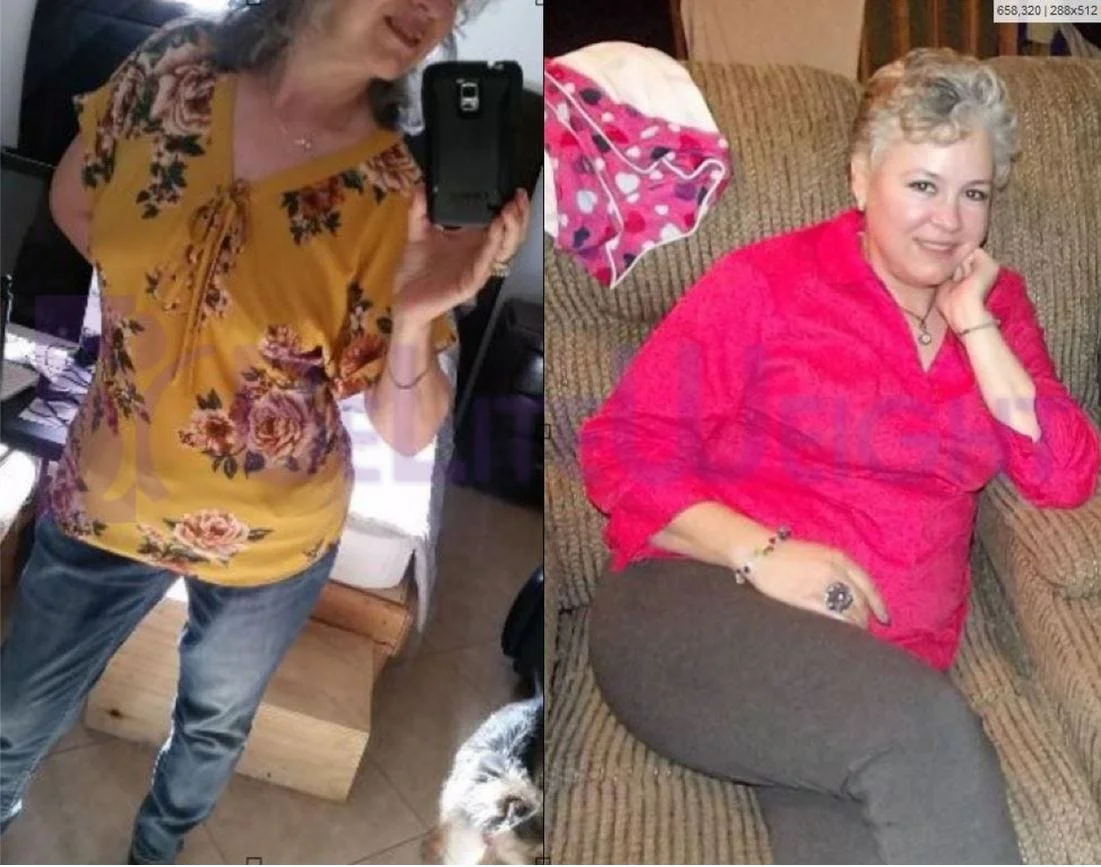 Weight Loss Surgery before and after Patient - Down 66 lbs so far, since my surgery on January 7 of this year. Never...