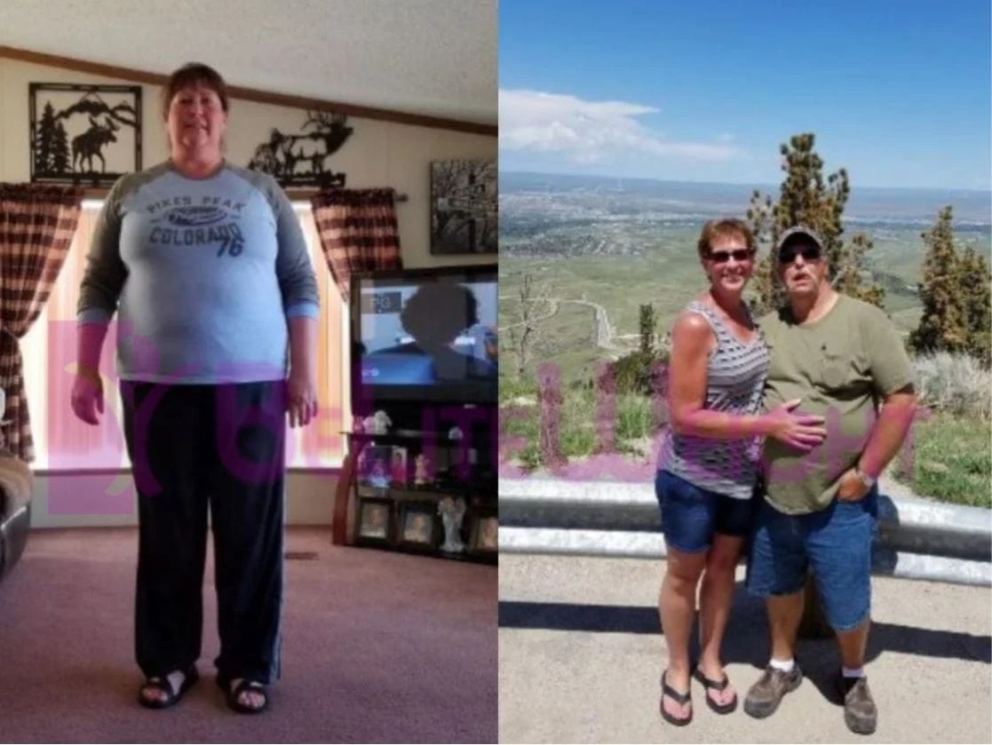 Weight Loss Surgery before and after Patient - I started at 298 lbs I had tried everything to lose weight and just could...