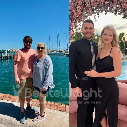 Hilary. D - gastric sleeve, update after 2 years*