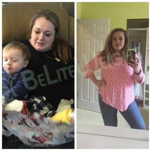 weight loss surgery before and after gastric bypass sleeve