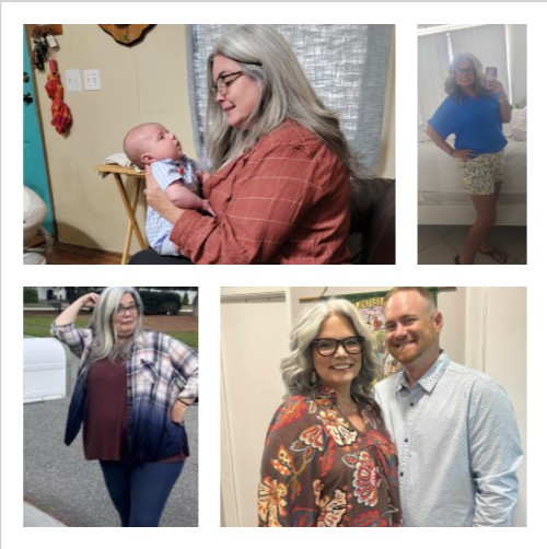 RNY Gastric Bypass before and after Patient - Our bariatric journey wasn&rsquo;t a quick decision&mdash;it came after years of trying, failing, and starting...