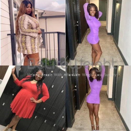 Weight Loss Surgery Before and After