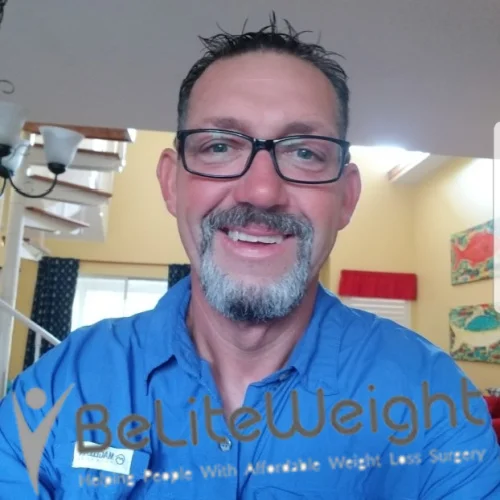 Weight Loss Surgery Gastric Sleeve before and after