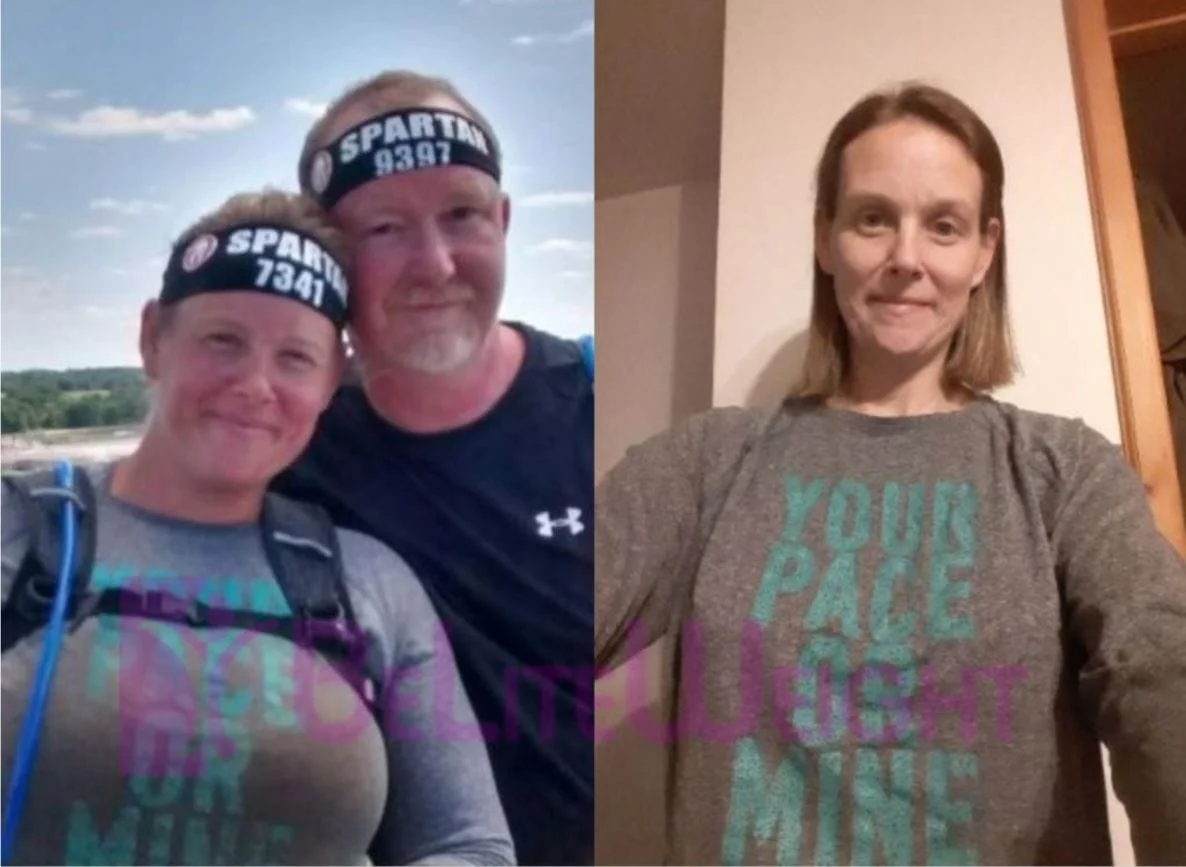 Weight Loss Surgery before and after Patient - I am extremely happy with my progress and so happy I had all the support.Surgeon...