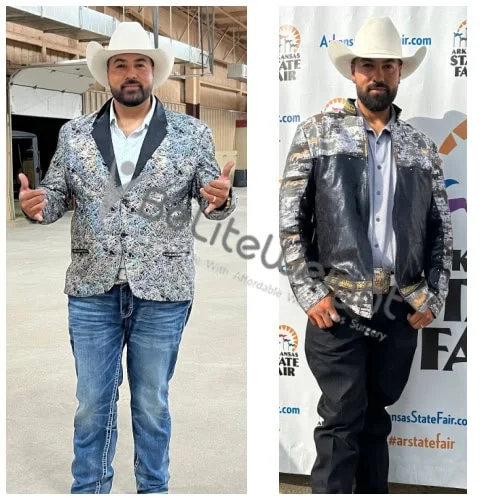 Gastric Sleeve before and after Patient - I'm doing great!! I have gotten down to 200 lbs and feel fantastic. Need to buy...