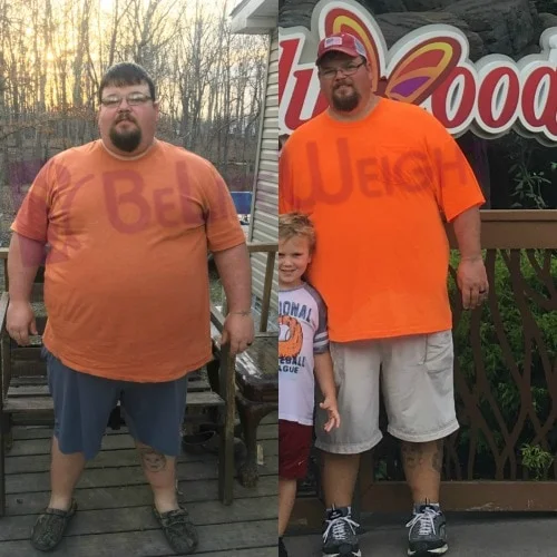 Weight Loss Surgery before and after Patient - 6 months after surgery 112 pounds lostSurgeon Dr. Jose Rodriguez and Elmo AramburoProcedure Gastric Sleeve *See...