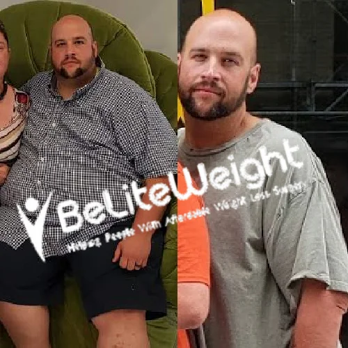 Gastric Sleeve before and after Patient - So 1 year out, I'm officially 200lbs less!! I went from a size 56 pant...