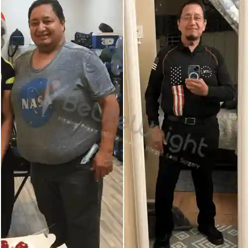 Gastric Sleeve before and after Patient - As you will see, the change is fantastic for me, as it has improved my...