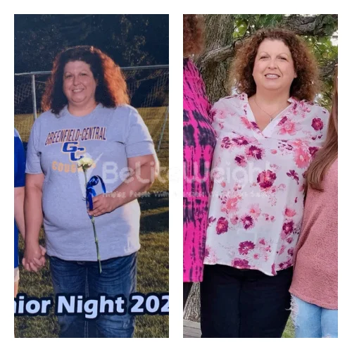 Gastric Sleeve before and after Patient - Hi JoAnne. I don't think I am losing anymore. Just maintaining I think. I try...