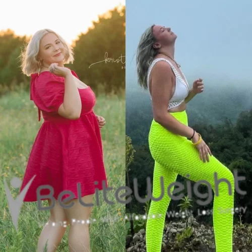 Weight Loss Surgery Gastric Sleeve before and after