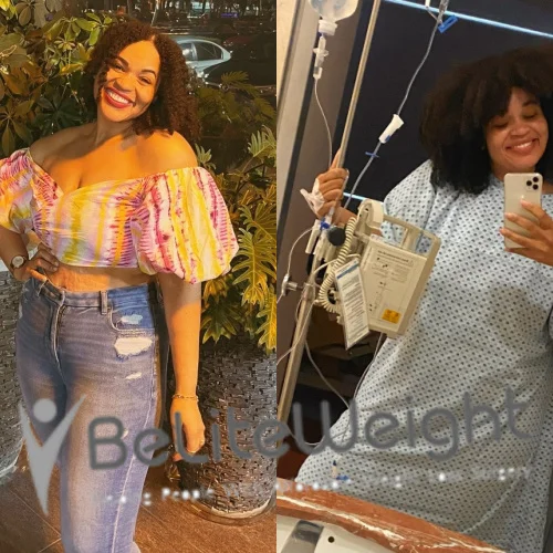 Weight Loss Surgery Before And After