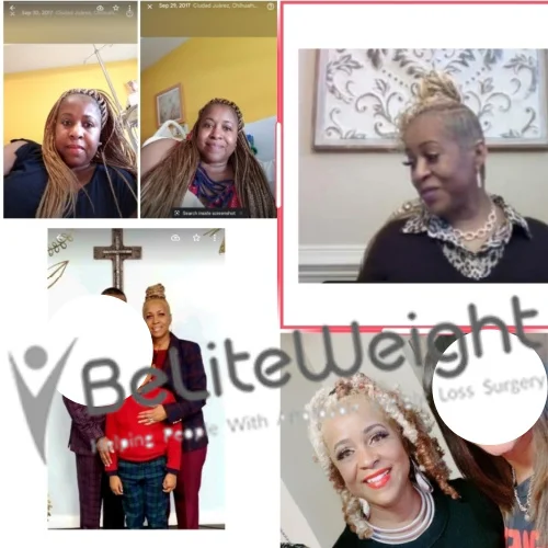 Gastric Sleeve before and after Patient - Hey! The top pic was while in the hospital there. The bottom right is 2...