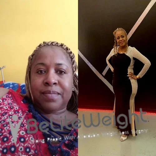 Weight Loss Surgery Before And After