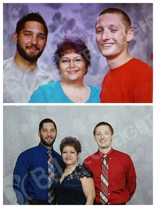 weight loss surgery vsg vertical sleeve gastrectemy bypass bariatric