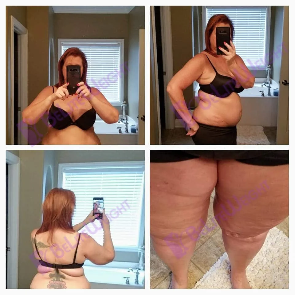 Weight Loss Surgery before and after Man - I will say that he and I were completely impressed with Dr Rod and staff...