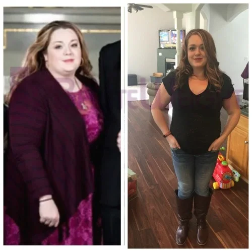 Weight Loss Surgery before and after Patient - Starting weight at time of surgery was 267 lbs and current weight is 160 lbs.Surgeons...