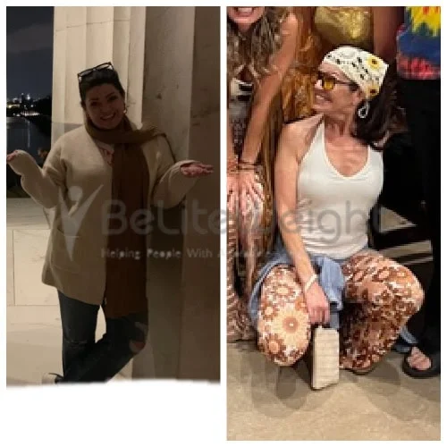 RNY Gastric Bypass before and after Patient - Hi JoAnneI can't believe it's been 2 years already!!! So I started at 185(ish) And in the...