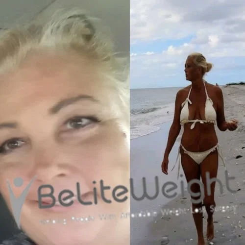 Weight Loss Surgery Before And After