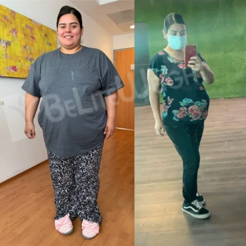 Weight Loss Surgery