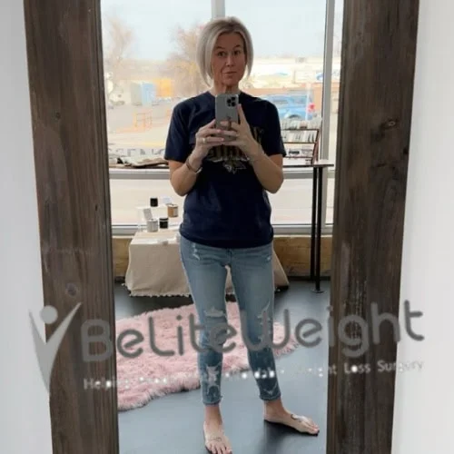 Sleeve to RNY Bypass Revision before and after Patient - Have lost way more since last update I think I am just maintaining now. Current...