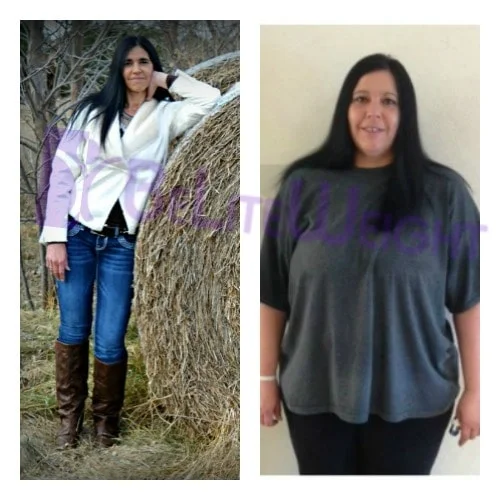 weight loss surgery vsg gastric sleeve before after photos testimonial revision after lap band