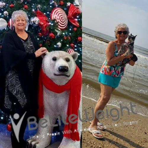 Weight loss before and after