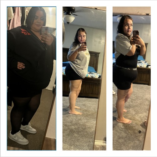 Natalie D.  Mini Gastric Bypass Update After 6 Months*