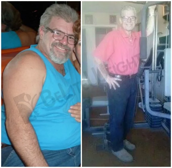 Weight Loss Surgery before and after Patient - It was the BEST $$ I've ever spent!! Mar 25th is my 1 year re-birthday...