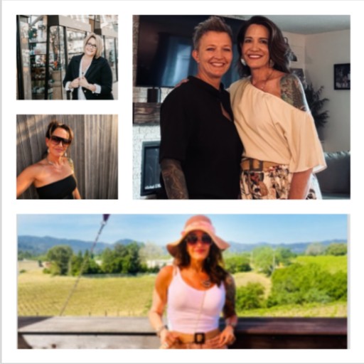Mini Gastric Bypass before and after Woman - Five years.It&rsquo;s hard to believe it has been five years since weight loss surgery-and sometimes...