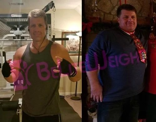 Weight Loss Surgery before and after Patient - Surgeon Dr. Elmo AramburoProcedure Gastric Sleeve I have lost close to 100lbs, I am working out four...