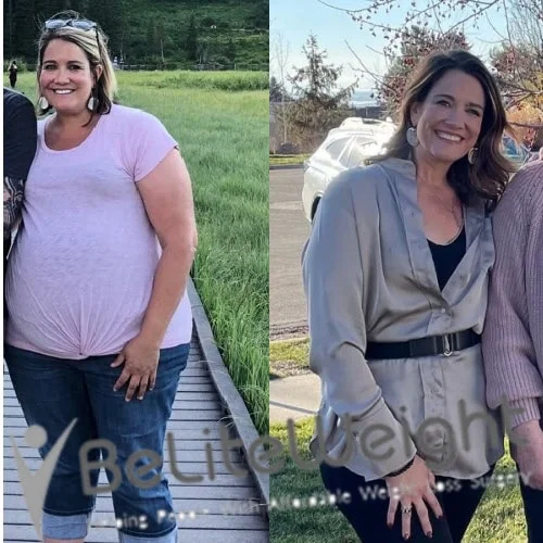 Weight Loss Surgery Before And After