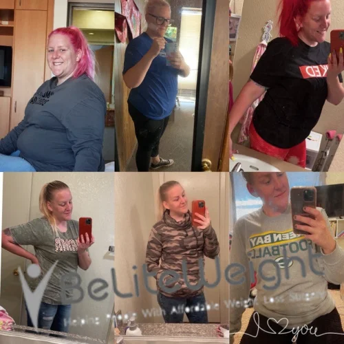 Weight Loss Surgery Before And After