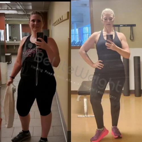 Gastric Sleeve before and after Patient - Hello! I am doing great! Down about 75lbs. Size 18 to size 10. Feeling great...