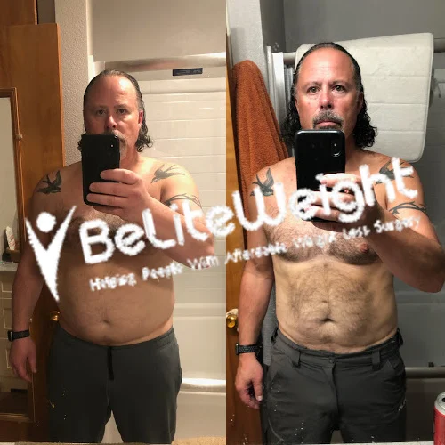 Gastric Sleeve before and after Patient - I'm pretty close to goal.  My weight on January 14, 2021 was 262lbs and today...