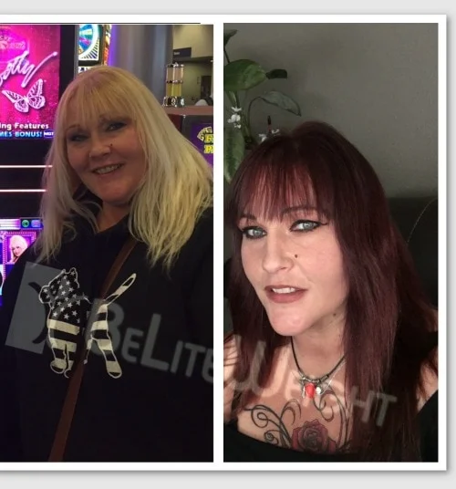 Weight Loss Surgery before and after Patient - Hi my name is Shaylee and I had my gastric sleeve surgery on May 12th...