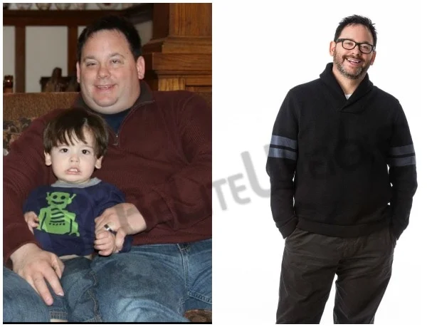 Tim - Before and After Sleeve Gastrectomy