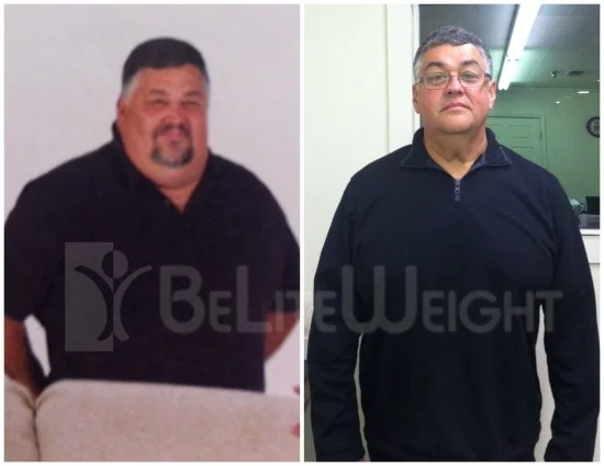 Weight Loss Surgery before and after Man - Thanks for all you have done to make my transformation back to a active life...